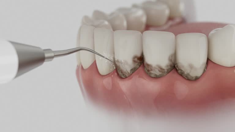 Trusted Tooth Extraction service in Louisa, VA - Dentist Open Now